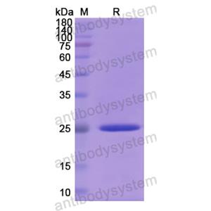 重组DDX58蛋白,Recombinant Human DDX58, N-His