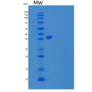 Recombinant Mouse Hyaluronan-Binding Protein 2/HABP2 Protein(C-6His)