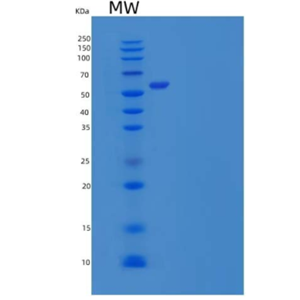 Recombinant Human PACSIN2/Syndapin-2 Protein(C-6His)