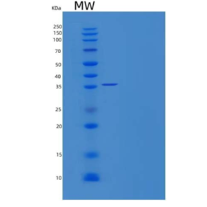 Recombinant Human Trans-2-Enoyl-CoA Reductase Mitochondrial/MECR Protein(C-6His)