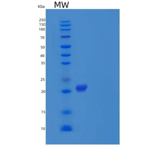 Recombinant Mouse IL-1 Receptor Antagonist Protein/IL-1ra/IL-1RA Protein