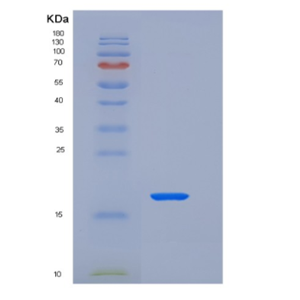 Recombinant Human Parathyroid Hormone-Related Protein/PTHLH Protein(C-6His),Recombinant Human Parathyroid Hormone-Related Protein/PTHLH Protein(C-6His)