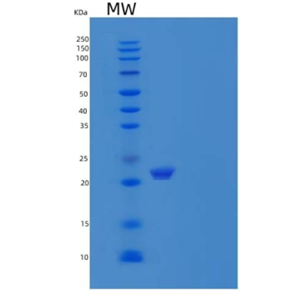 Recombinant Human Partner of Y14 and Mago/WIBG /PYM Protein(C-6His)