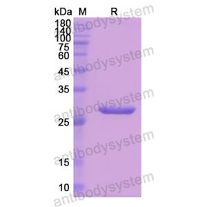 Recombinant Human ANGPTL1, N-His