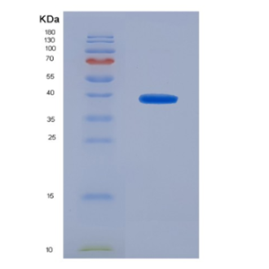 Eukaryotic Triggering Receptor Expressed On Myeloid Cells 1 (TREM1)