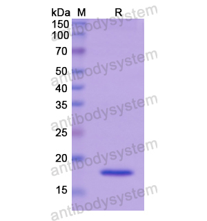 重组FADS2蛋白,Recombinant Human FADS2, N-His