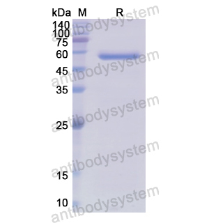 重组ITGBL1蛋白,Recombinant Human ITGBL1, C-His