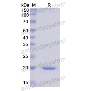 重组AGR2/HPC8蛋白,Recombinant Human AGR2/HPC8, N-His