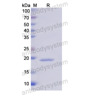 重組IL18BP蛋白,Recombinant Human IL18BP, N-His