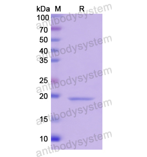 重组WNT11蛋白,Recombinant Human WNT11, N-His