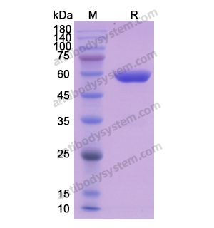 重组ALDH1A1蛋白,Recombinant Human ALDH1A1, N-His