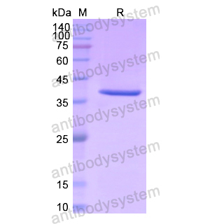 重組PAH蛋白,Recombinant Human PAH, N-His