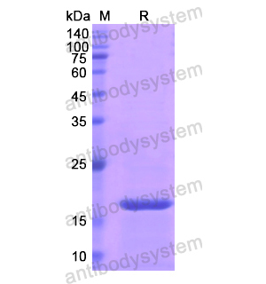 重组SOD1蛋白,Recombinant Human SOD1, N-His