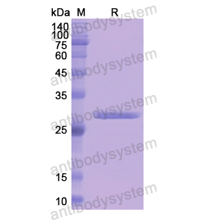 重組F13A1蛋白,Recombinant Human F13A1, N-His