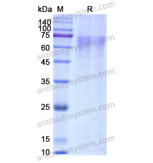 重组F9/Factor IX蛋白,Recombinant Human F9/Factor IX, C-His