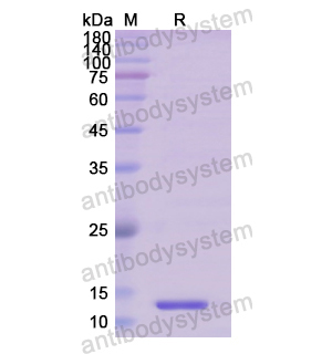 重组PLAT蛋白,Recombinant Human PLAT, N-His