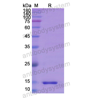 重组REN蛋白,Recombinant Human REN, N-His