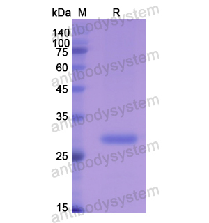 重组CA1蛋白,Recombinant Human CA1, N-His