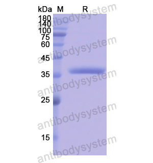 重組OAS1蛋白,Recombinant Human OAS1, N-GST