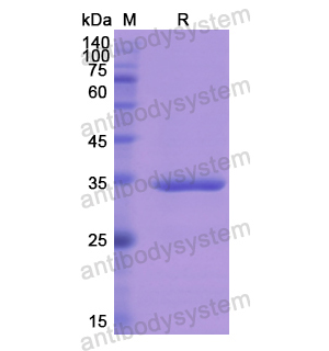 重组SPINK1蛋白,Recombinant Human SPINK1, N-GST