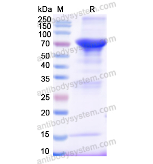 重组AGT蛋白,Recombinant Human AGT, N-GST