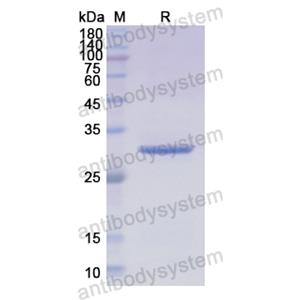 Recombinant Human SNAI1, N-His