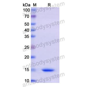 重组CD160蛋白,Recombinant Human CD160, N-His