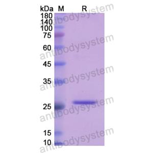 Recombinant Human GLUD1, N-His