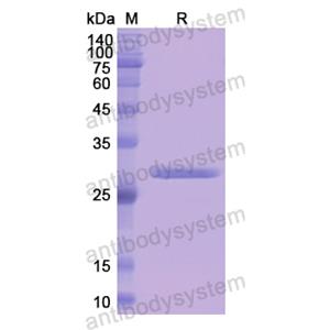 重組F13A1蛋白,Recombinant Human F13A1, N-His