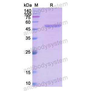 Recombinant Human HPRT1, N-GST