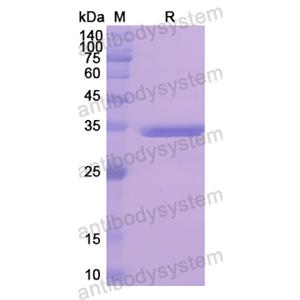 Recombinant Human EGFR, N-His