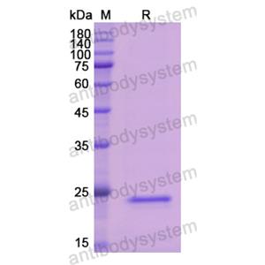 Recombinant Human CFB, N-His