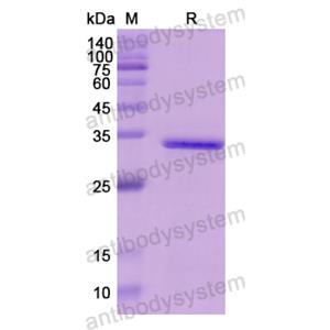 Recombinant Human ADA, N-His