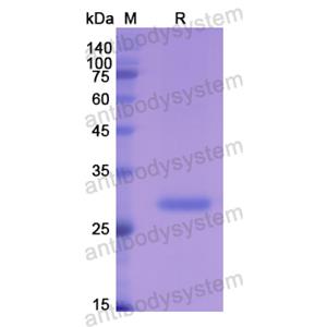 重组CA1蛋白,Recombinant Human CA1, N-His