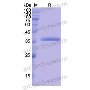 Recombinant Human OAS1, N-GST