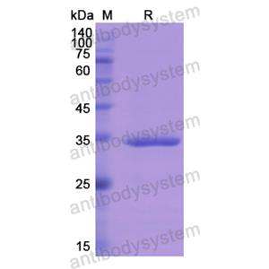 Recombinant Human SPINK1, N-GST