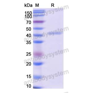 重组SERPINA3蛋白,Recombinant Human SERPINA3, N-GST