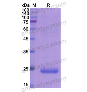 重组TIMP1蛋白,Recombinant Human TIMP1, N-His