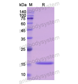 重組CST3蛋白,Recombinant Human CST3, C-His