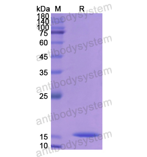 重組CST4蛋白,Recombinant Human CST4, N-His