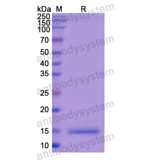 重組KNG1蛋白,Recombinant Human KNG1, N-His