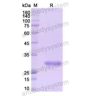 重組LDLR蛋白,Recombinant Human LDLR, N-His