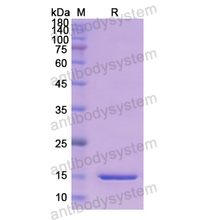 重组PENK蛋白,Recombinant Human PENK, N-His