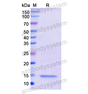 Recombinant Human FSHB, N-His