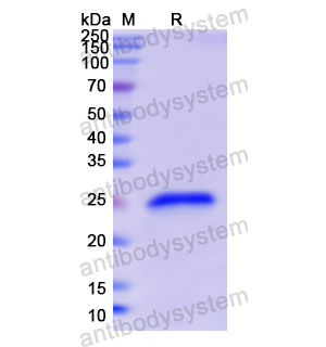 重组GH1蛋白,Recombinant Human GH1, N-His