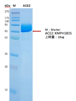 重组人ACE2蛋白,Recombinant Human ACE2 Protein, His Tag