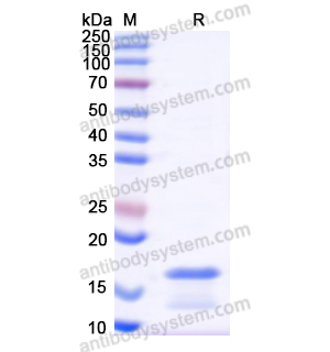 重组PCT/Procalcitonin 蛋白,Recombinant Human PCT/Procalcitonin Protein, N-His