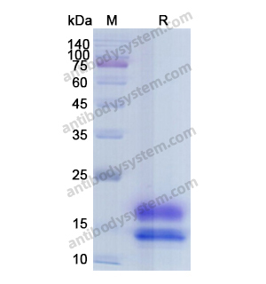 重组PCT/Procalcitonin Protein蛋白,Recombinant Human PCT/Procalcitonin Protein, C-His