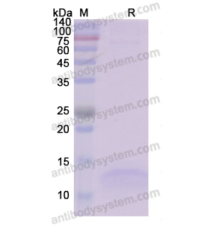 重組PTH蛋白,Recombinant Human PTH, C-His