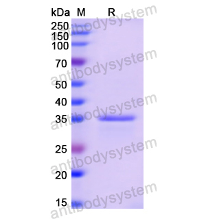 重組GAST蛋白,Recombinant Human GAST, N-GST